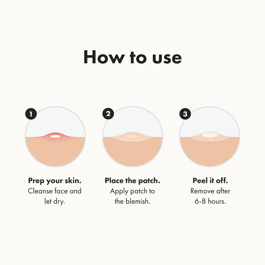 Mighty Patch™ Original patch from Hero Cosmetics – The #1 Hydrocolloid Acne Pimple Patch for Shrinking Zits and Whiteheads